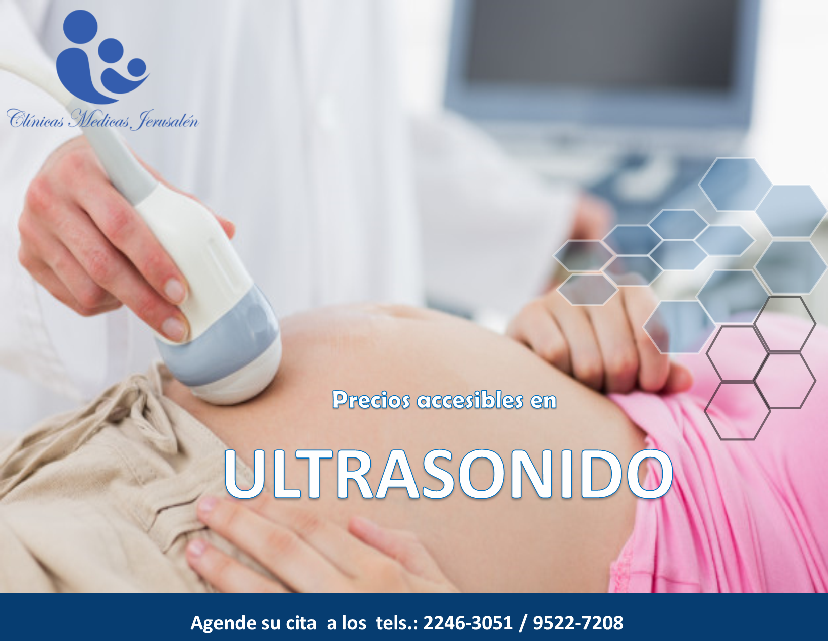Ultrasonido