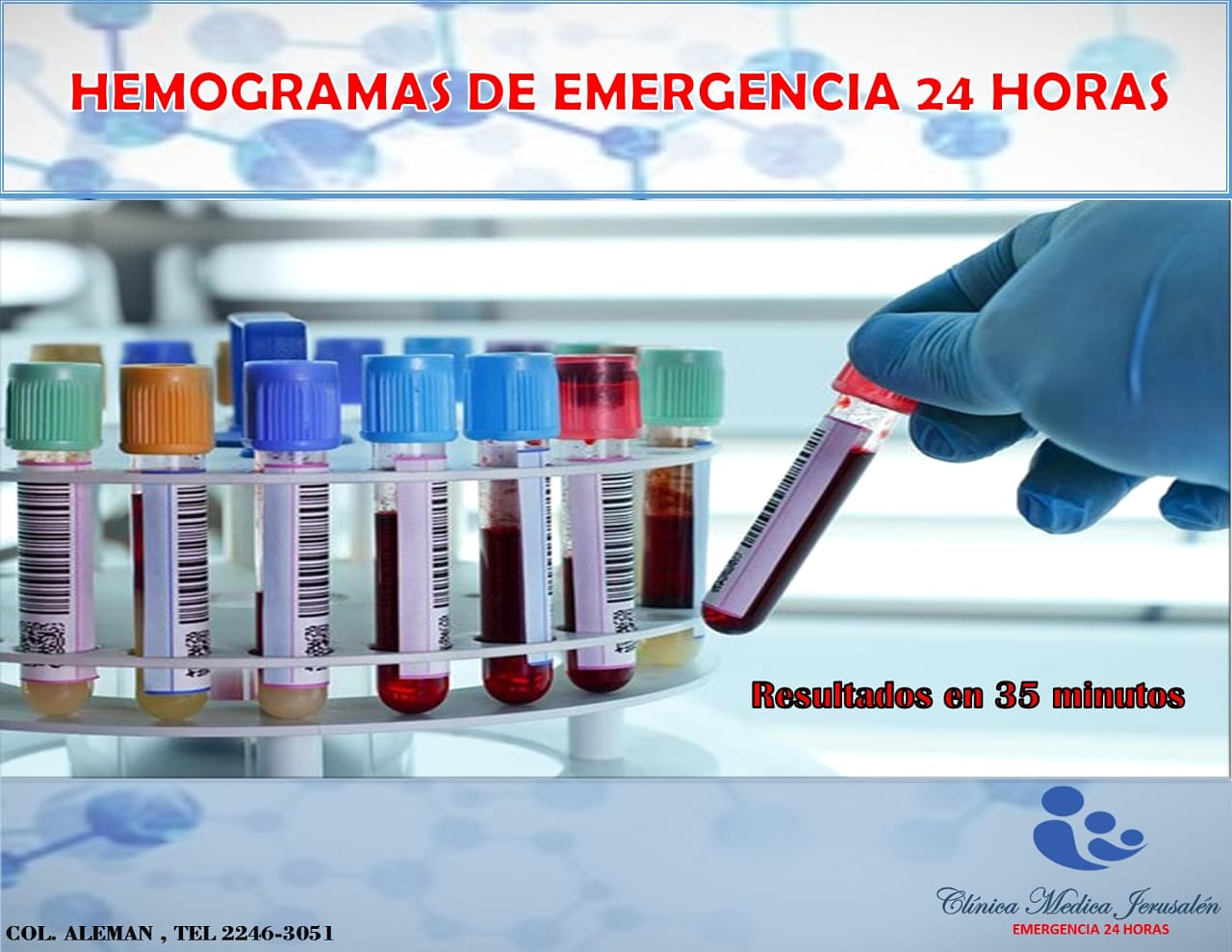 Hemograma