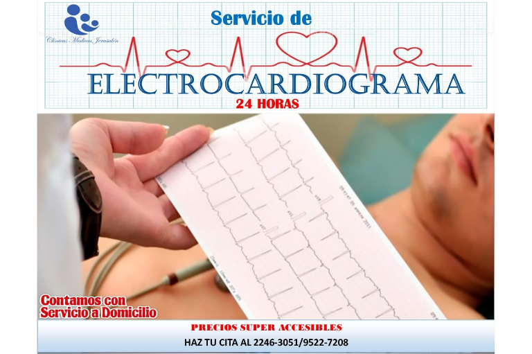 Servicio 4